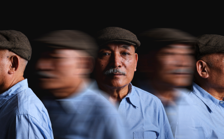 Brain Vitamins Against Dementia